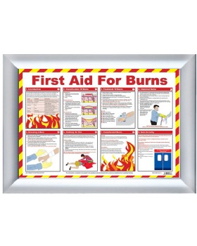 Burns Treatment - Action Wall Chart